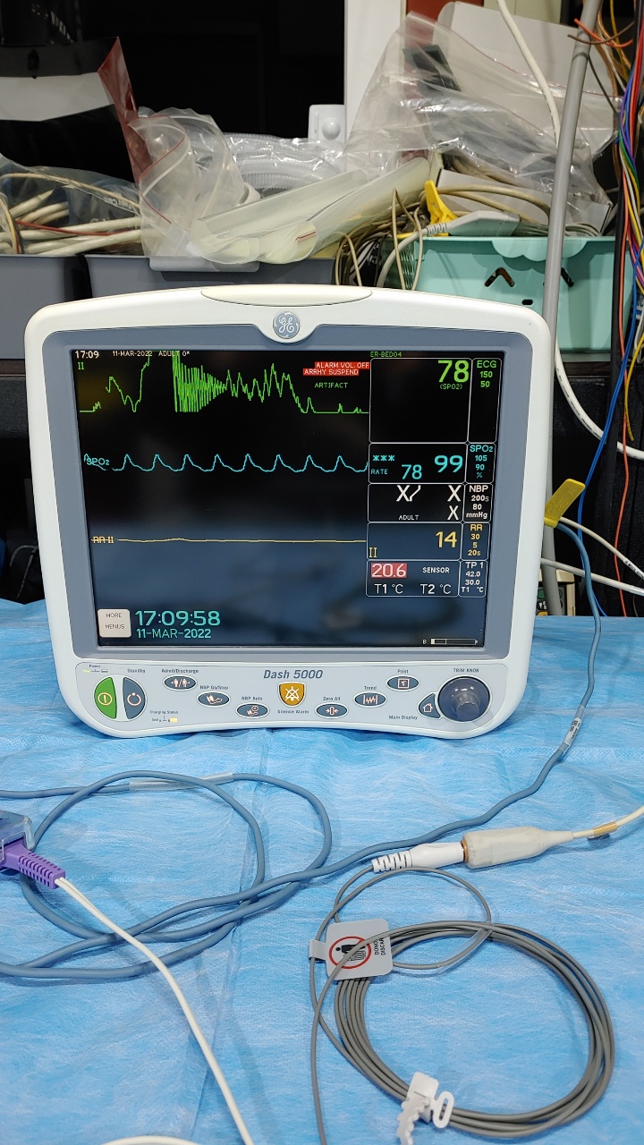 GE Dash 5000 Patient Monitor