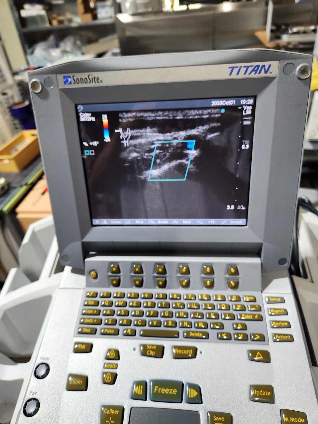 SonoSite Titan ultrasound machine