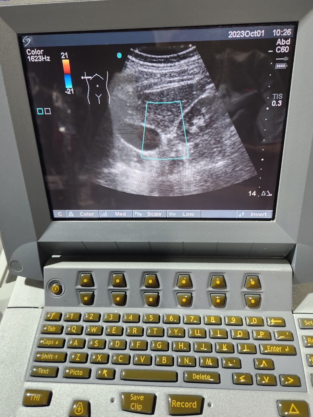 SonoSite Titan ultrasound machine