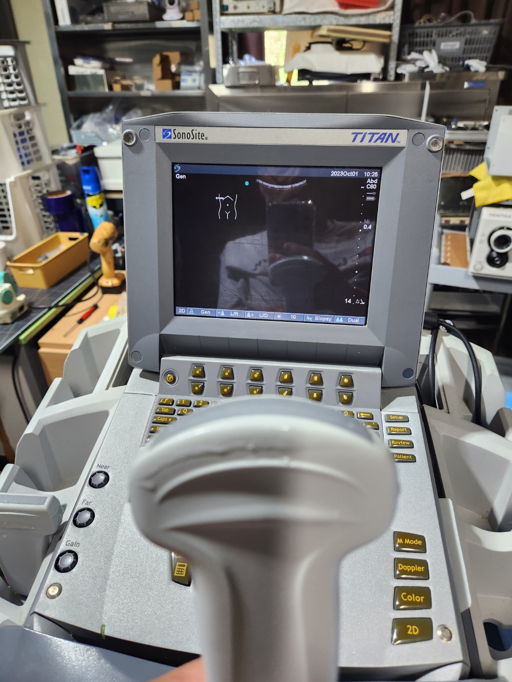 SonoSite Titan ultrasound machine