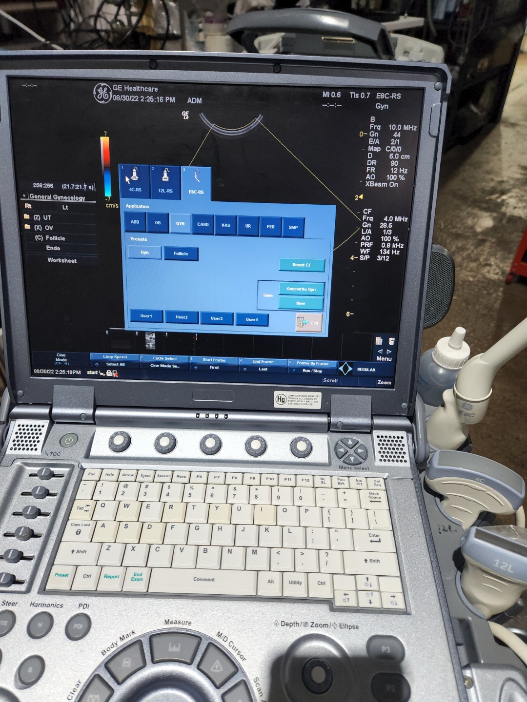 GE logiq e portable ultrasound system