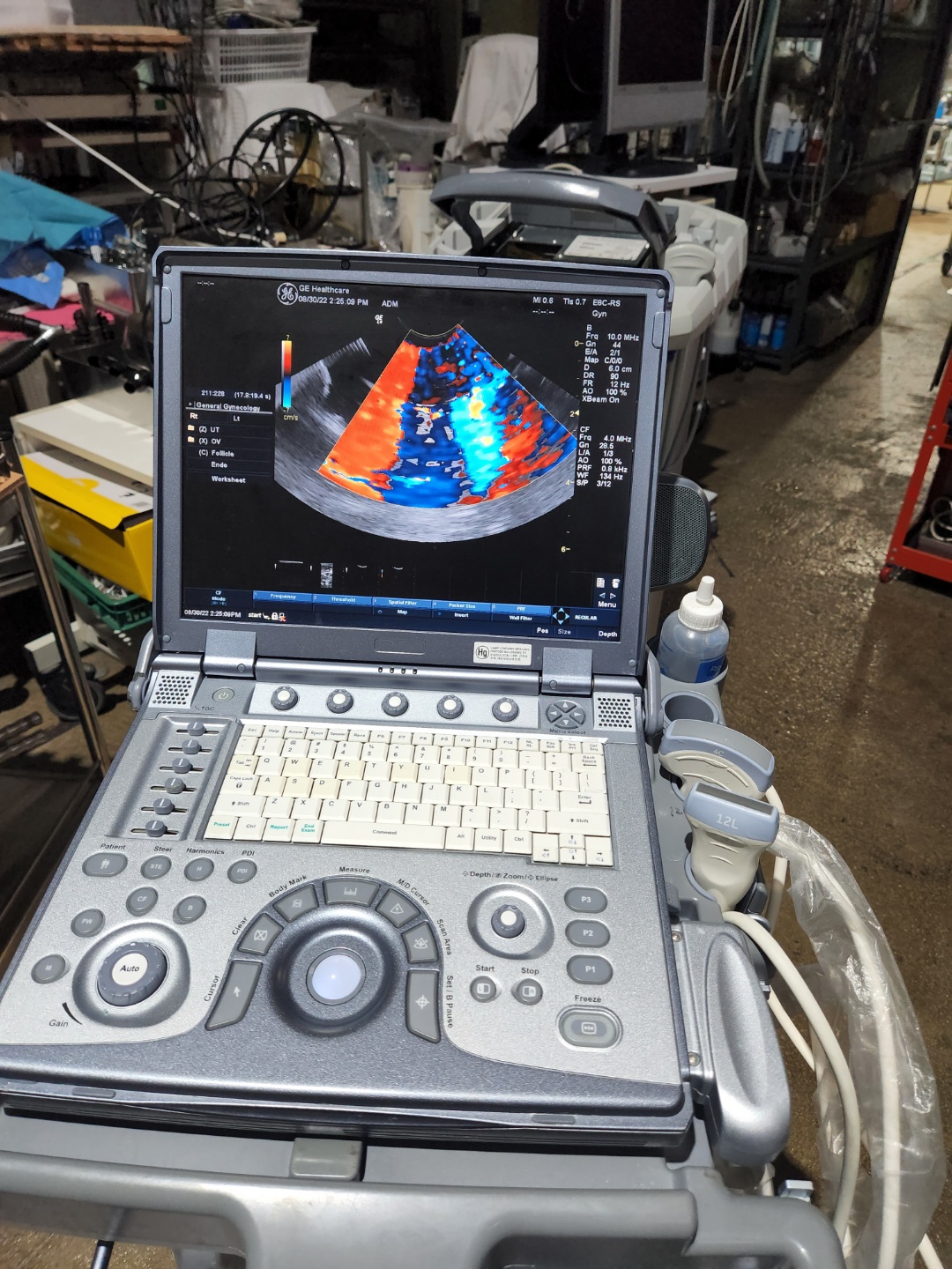 GE logiq e portable ultrasound system