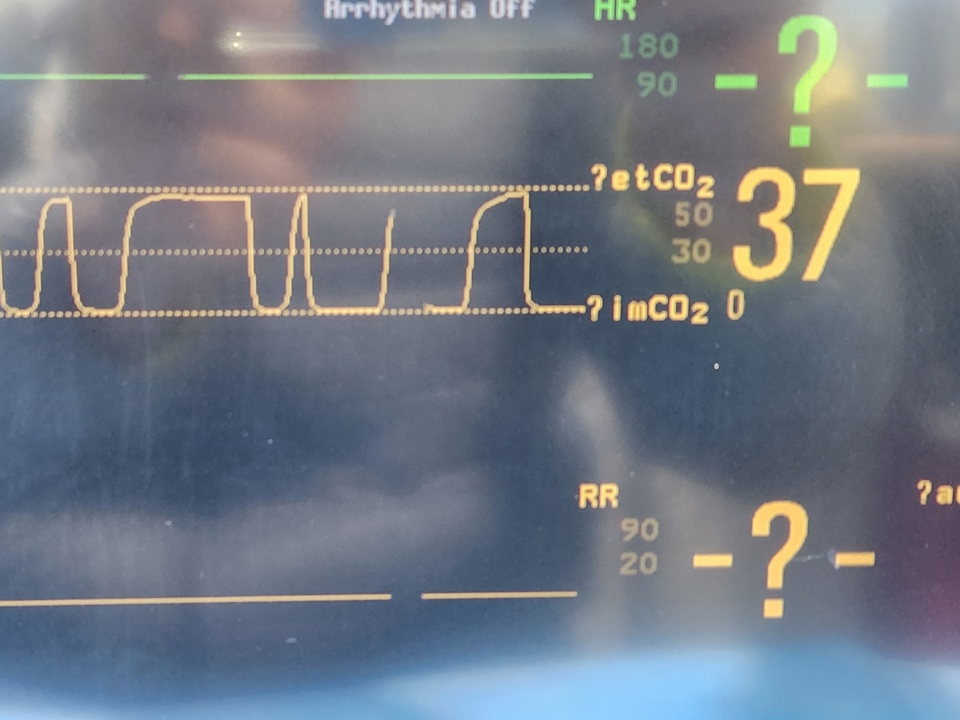 IntelliVue MP 40/ 50 Patient Monitor