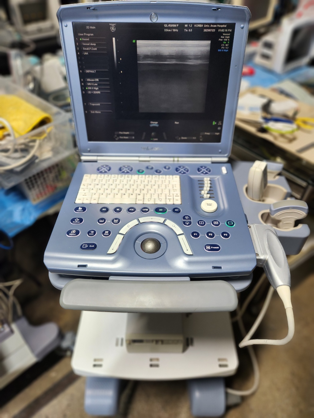 GE Voluson i Portable Ultrasound With 2 Probes