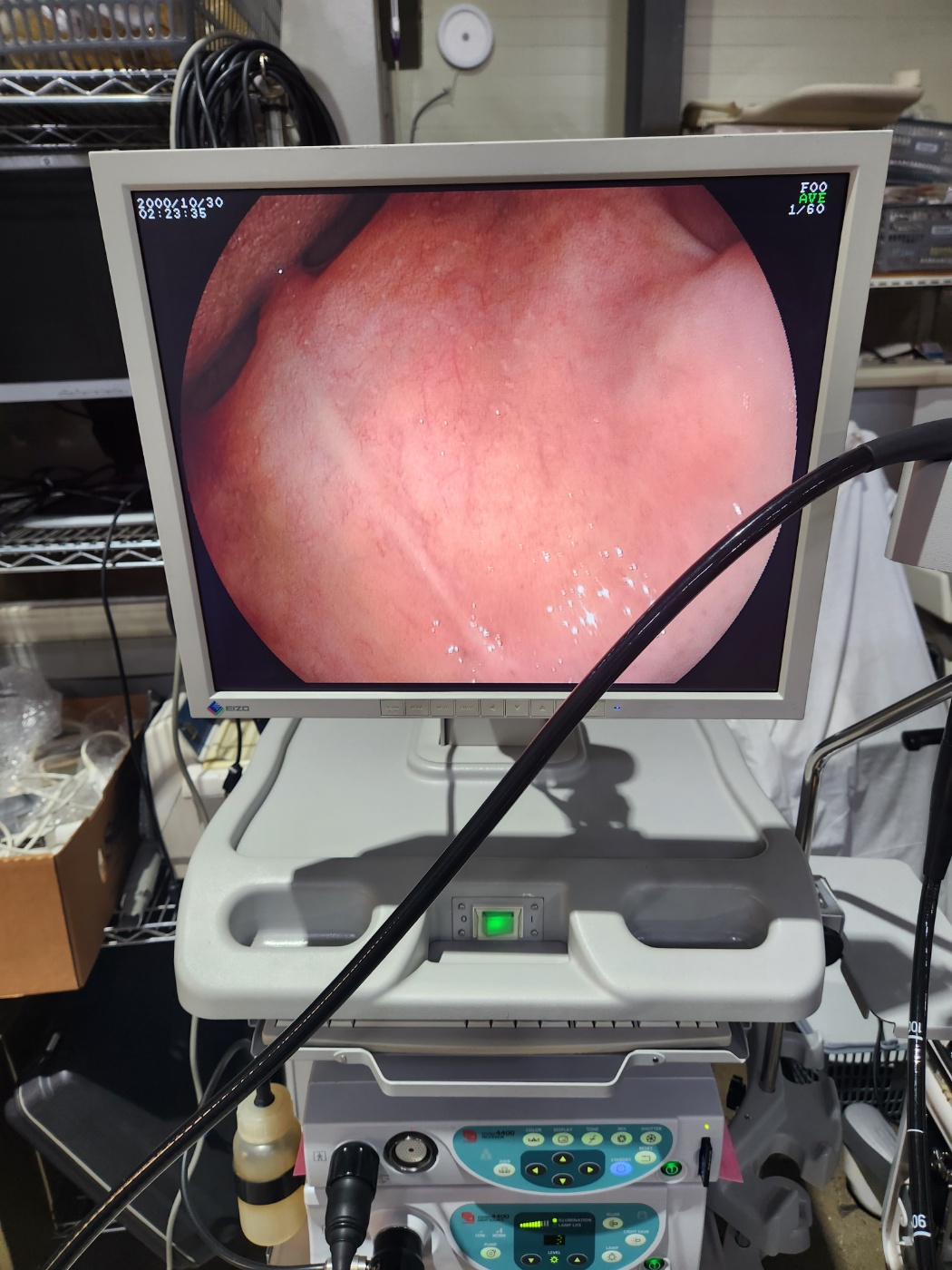 Fujinon VP-4400, XL-4400 Endoscopy System