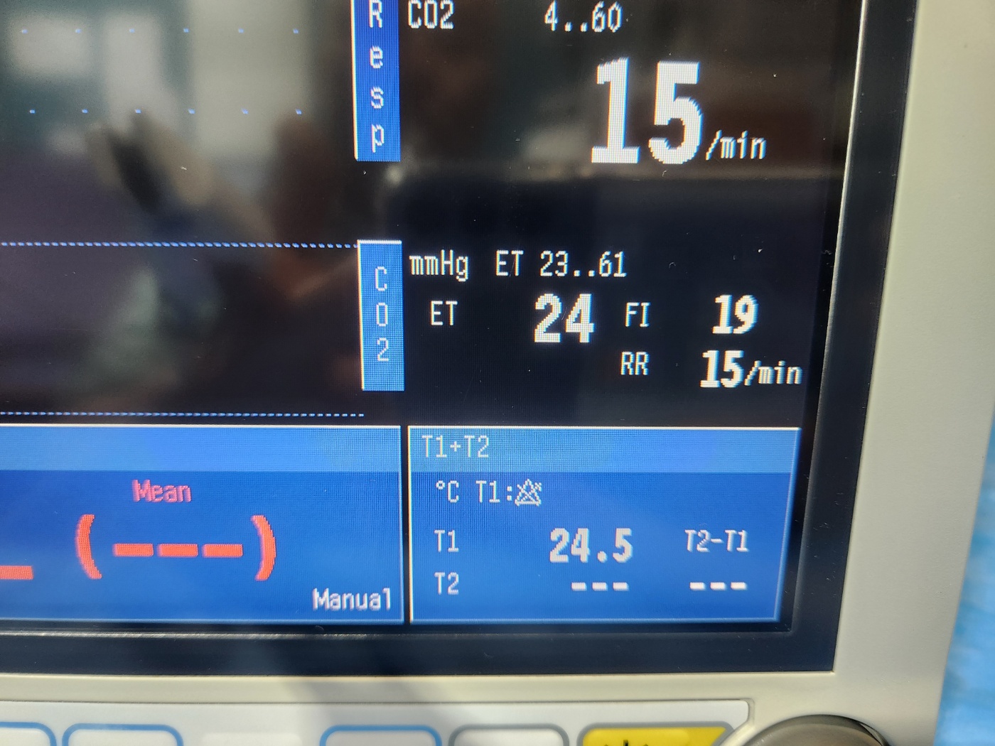 GE B40 Patient Monitor