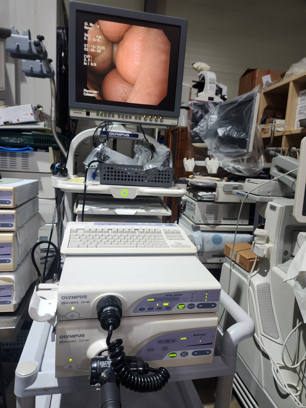 Olympus CV-160 Endoscopy System