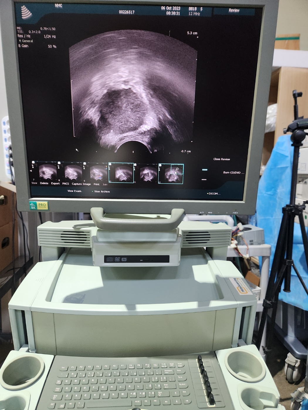 BK Pro Focus Portable Ultrasound System