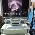 BK Pro Focus Portable Ultrasound System