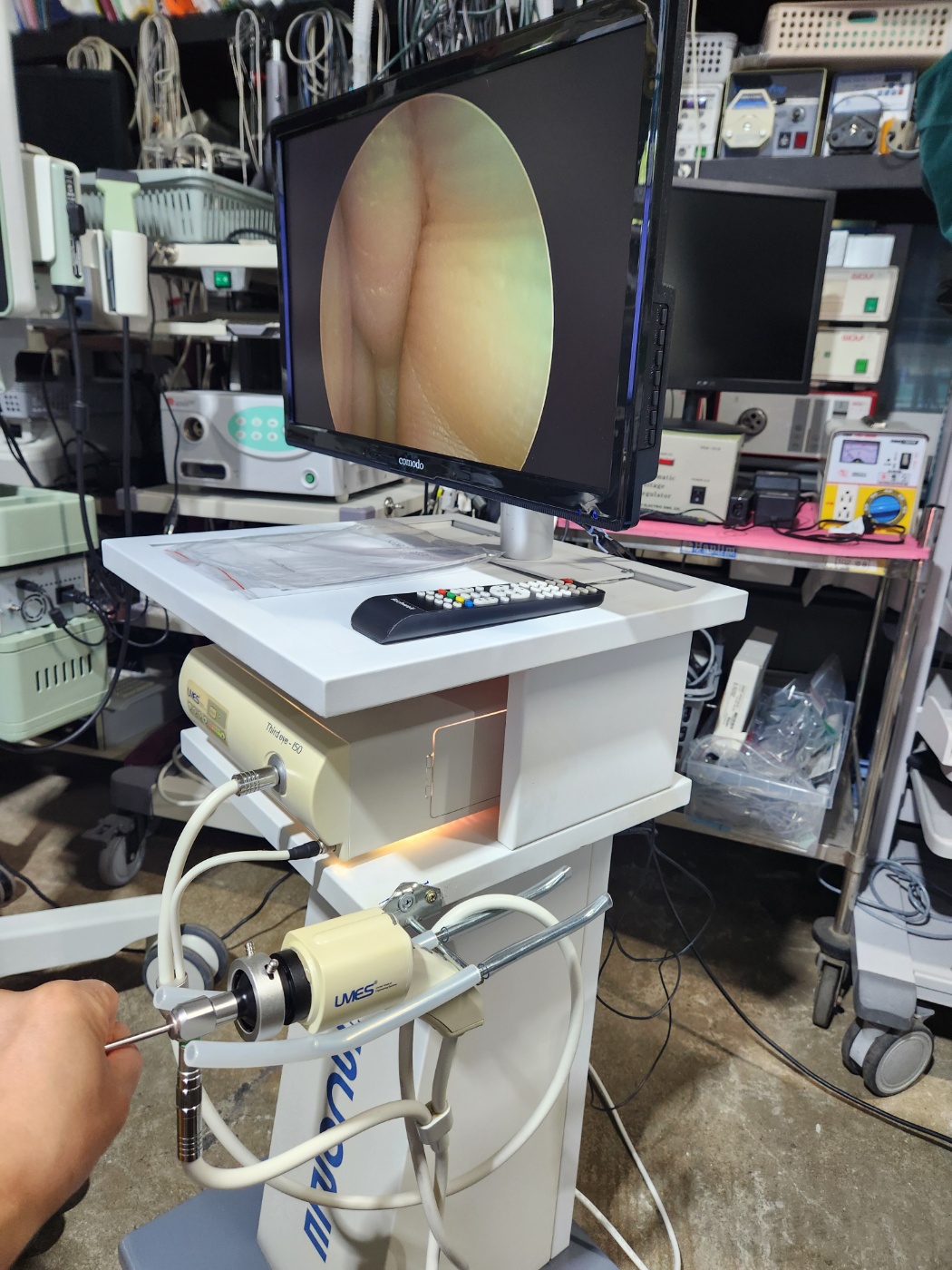 Third-eye umes endoscope system