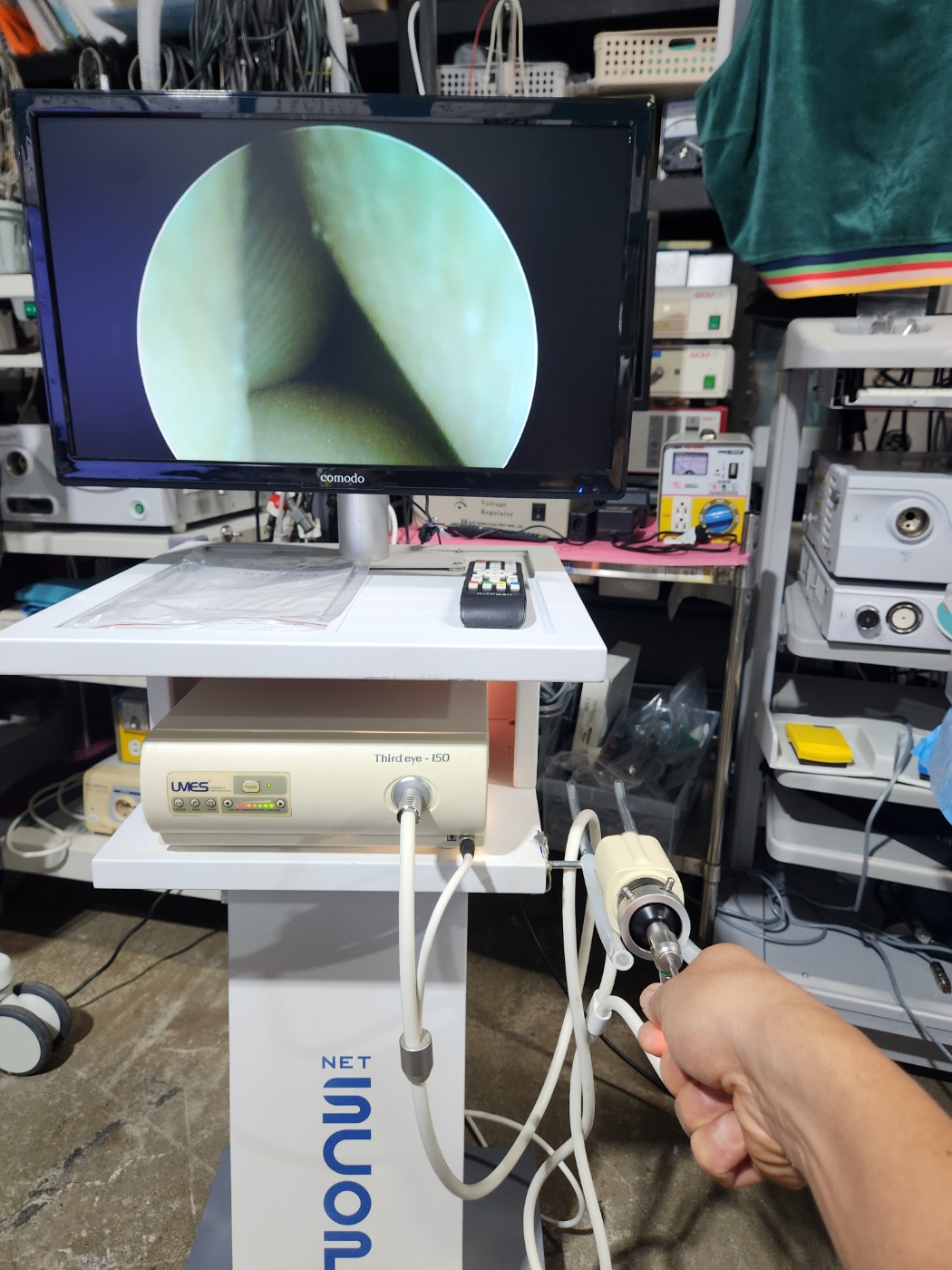 Third-eye umes endoscope system