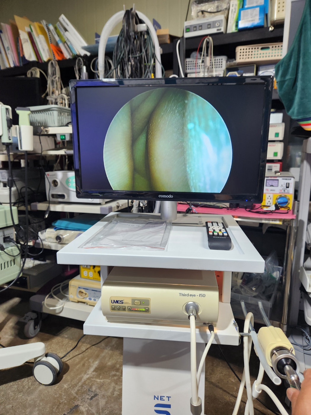 Third-eye umes endoscope system