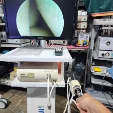 Third-eye umes endoscope system