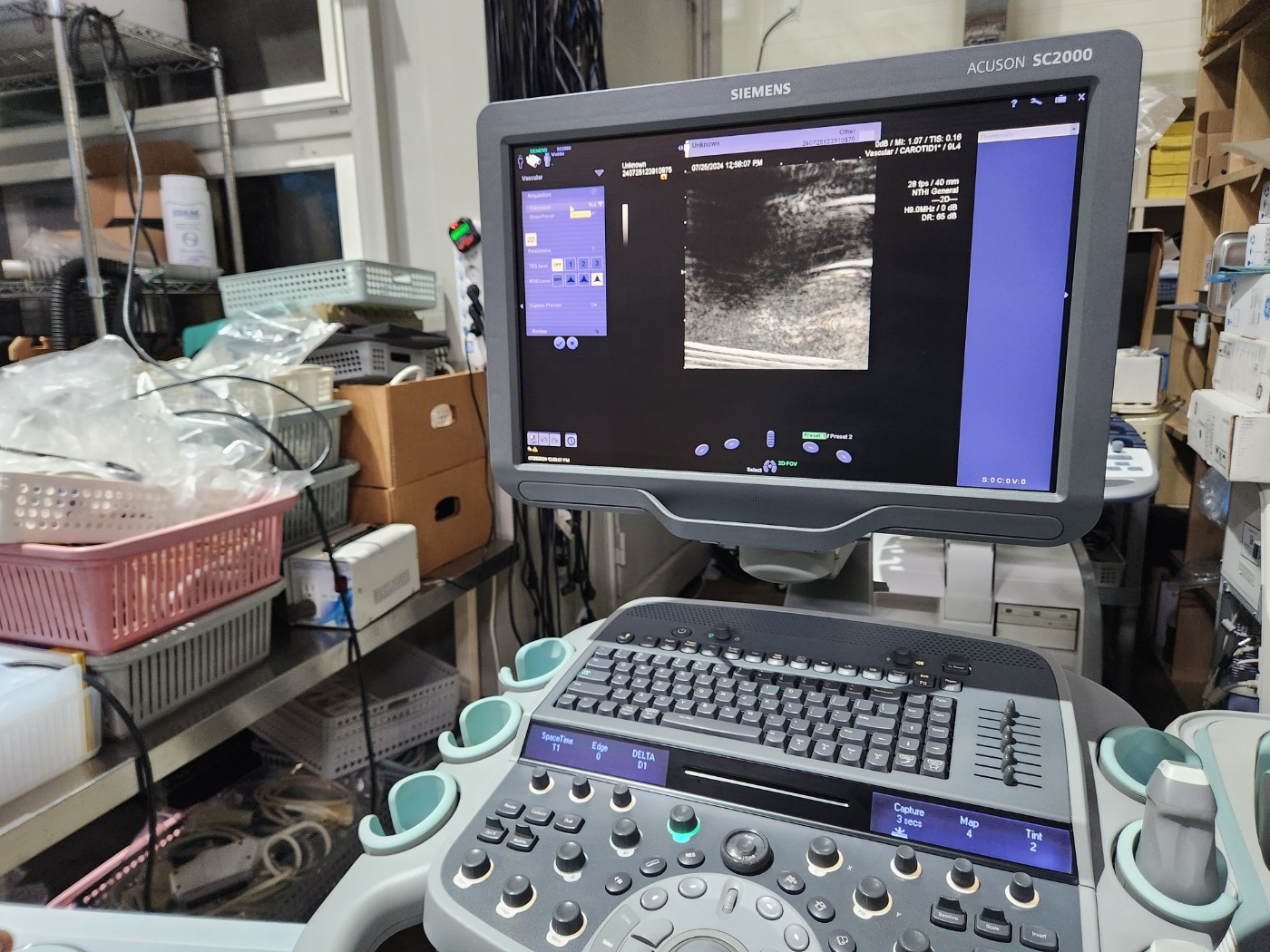 Siemens Acuson SC2000 Ultrasound System