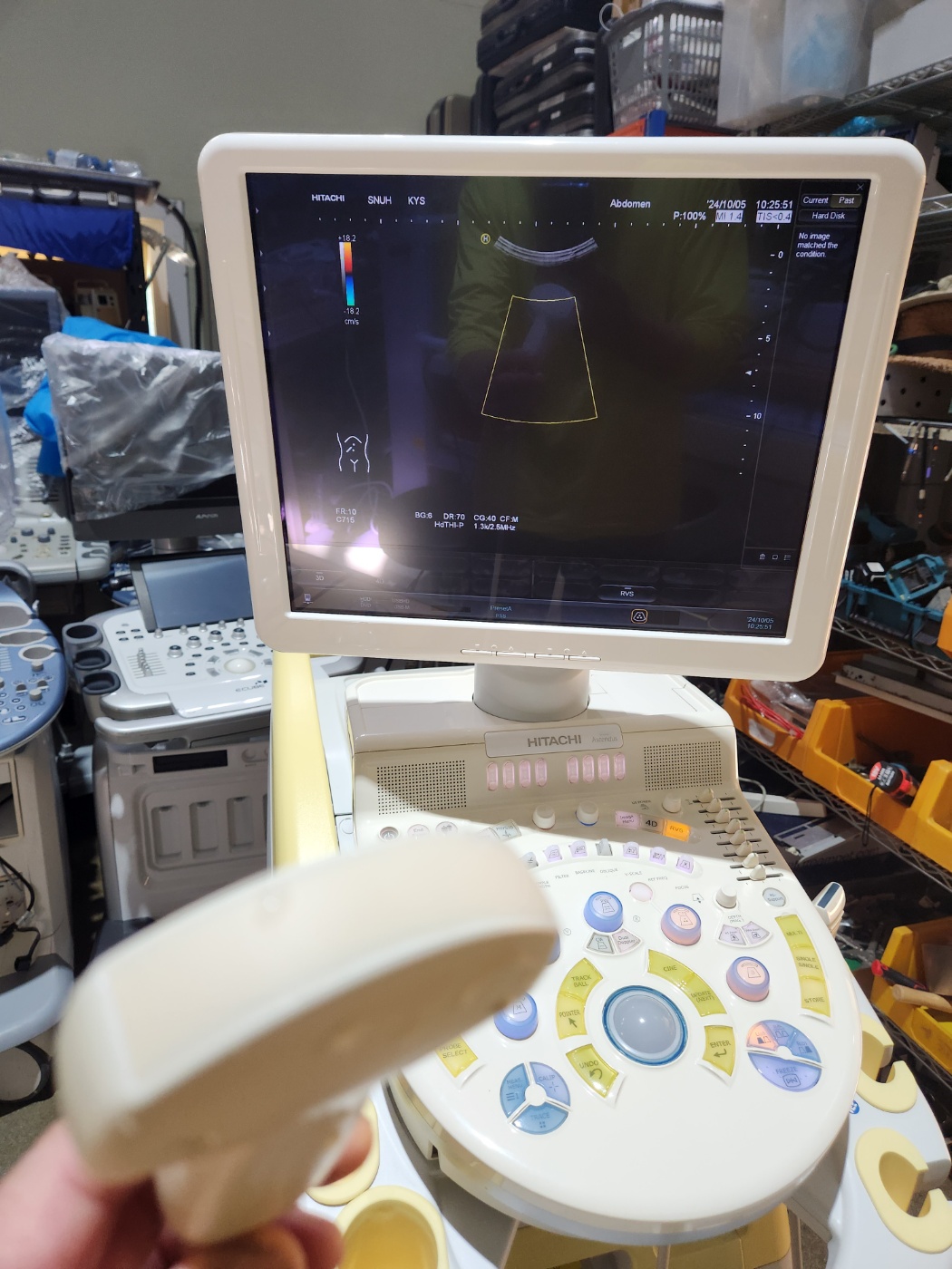 HITACHI Hi Vision Ascendus Ultrasound System