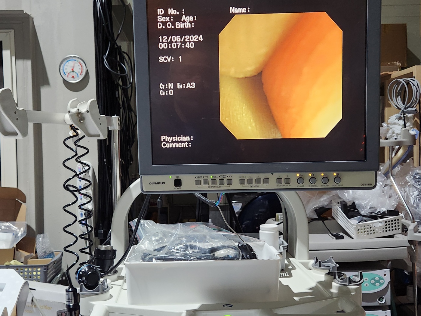 GF-UE260-AL5 Ultrasonic Gastrovideoscope