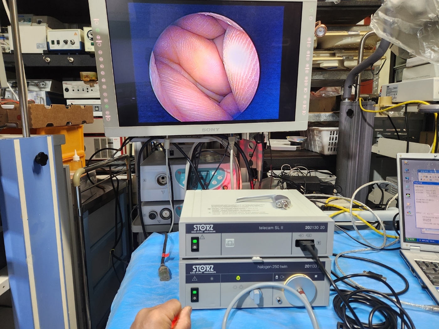 KARL STORZ DCI II system NTSC