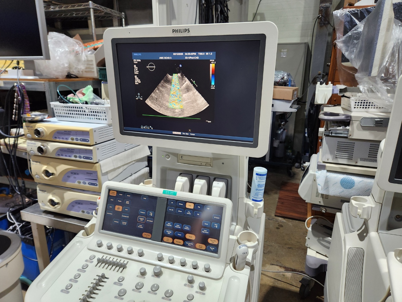 Philips IU33 Ultrasound Machine