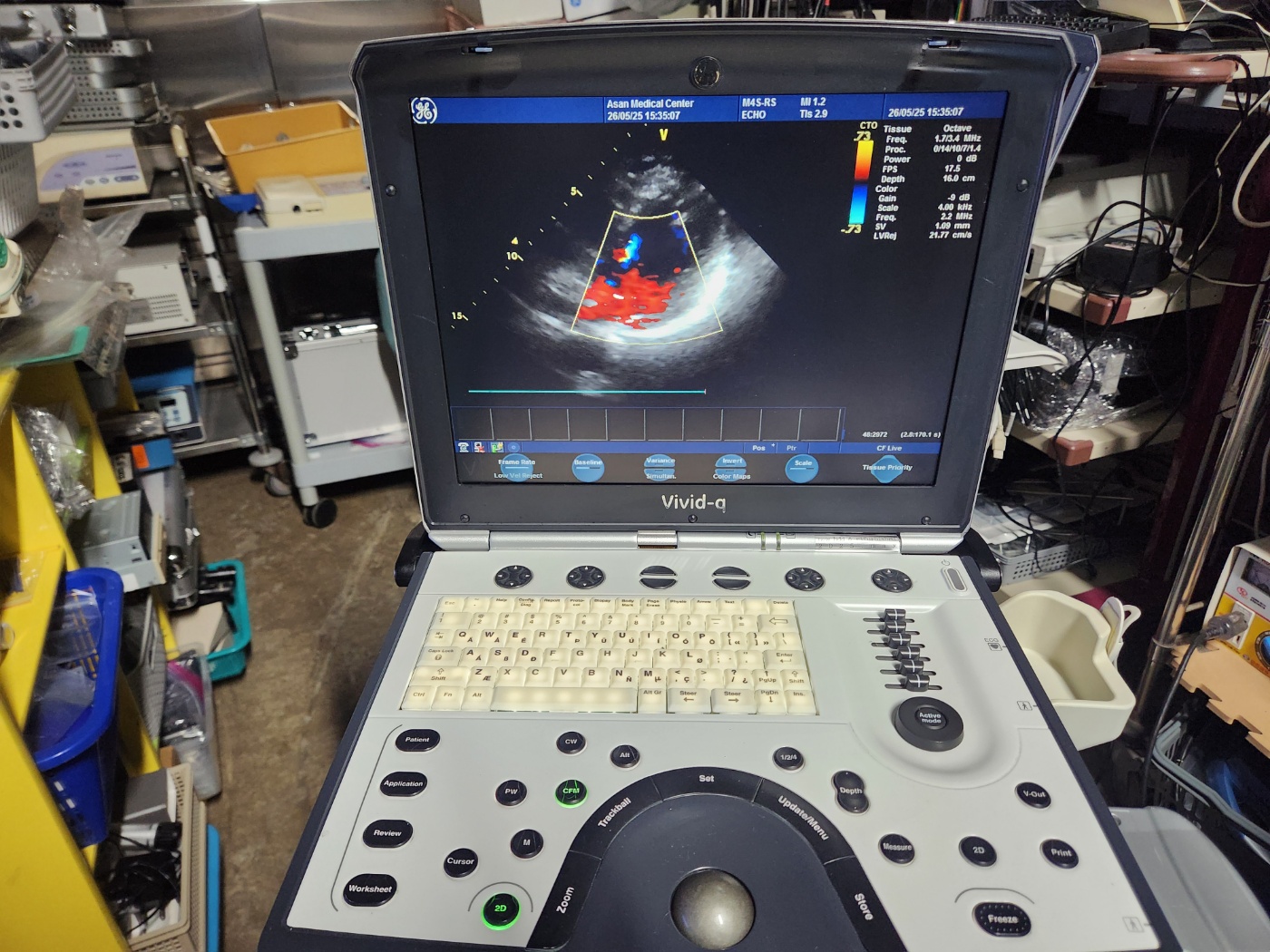 GE Vivid Q Portable Ultrasound