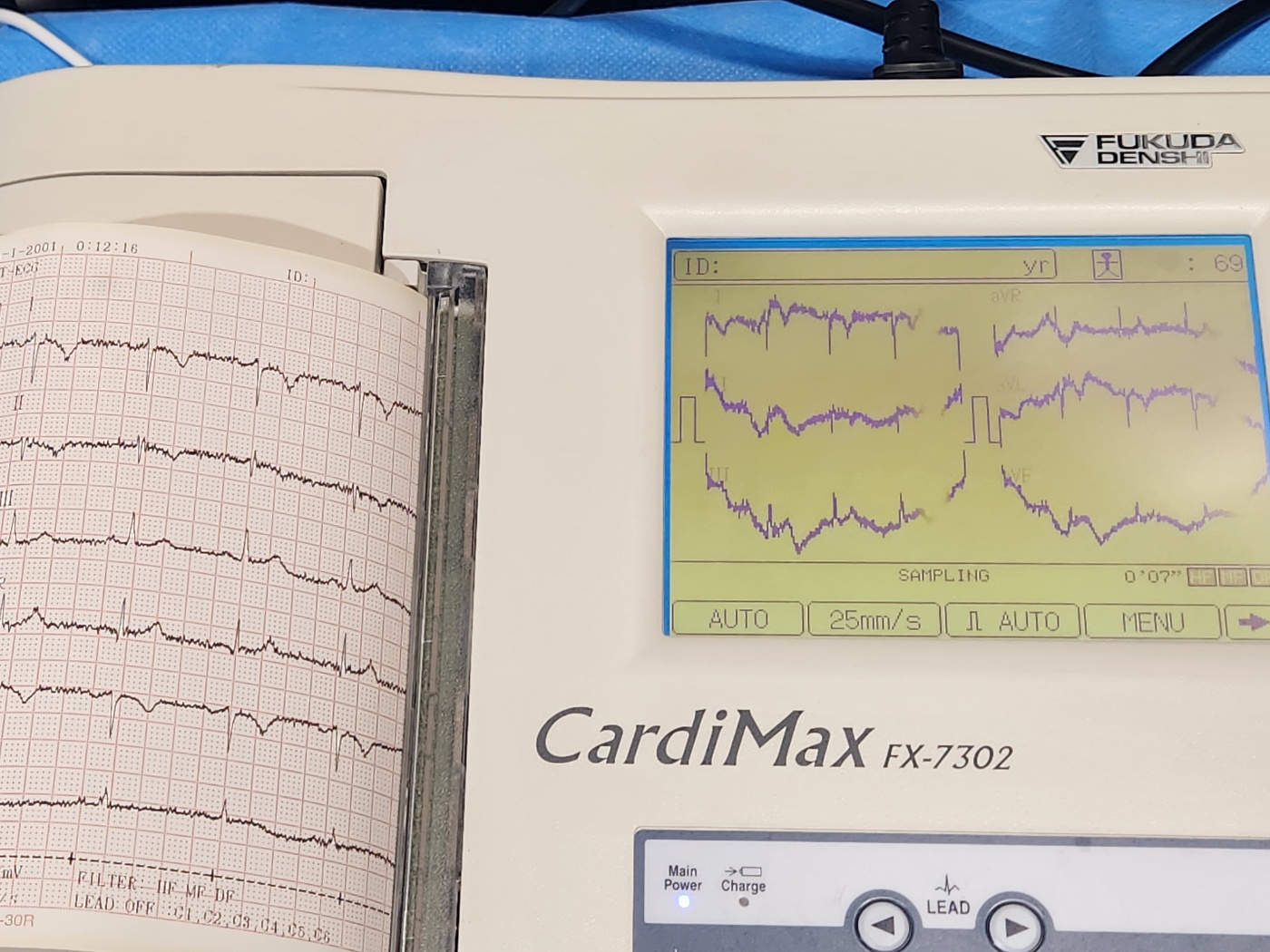 심전도검사기 CardiMax FX-7302