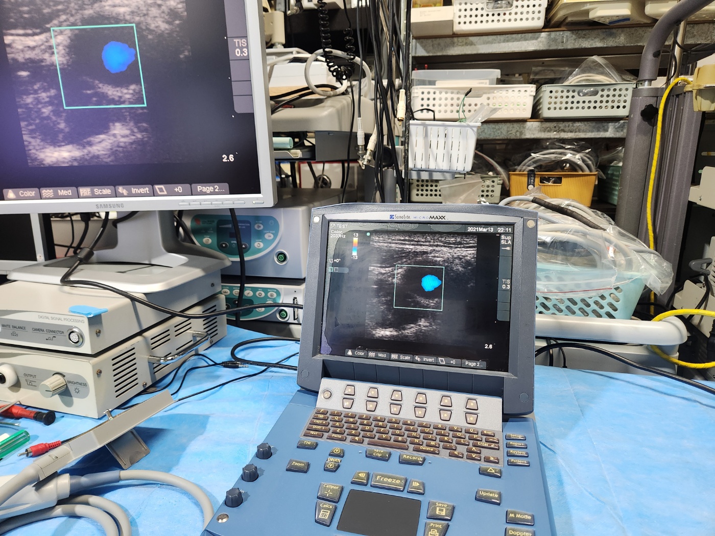 Sonosite MicroMaxx Ultrasound system
