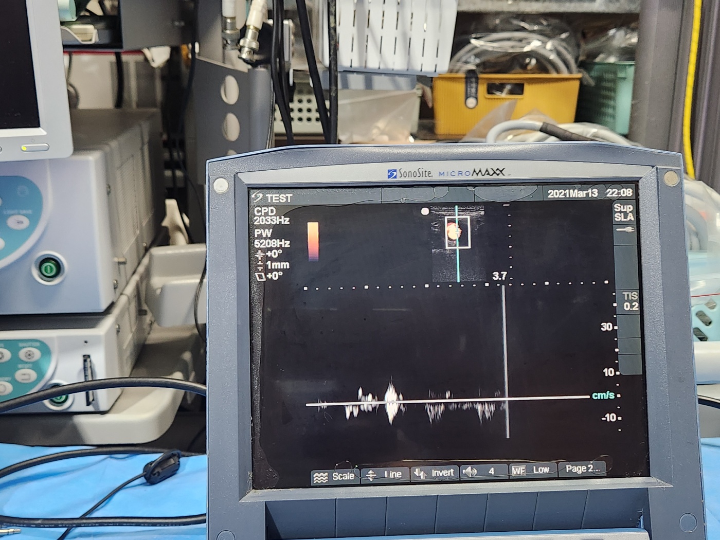 Sonosite MicroMaxx Ultrasound system
