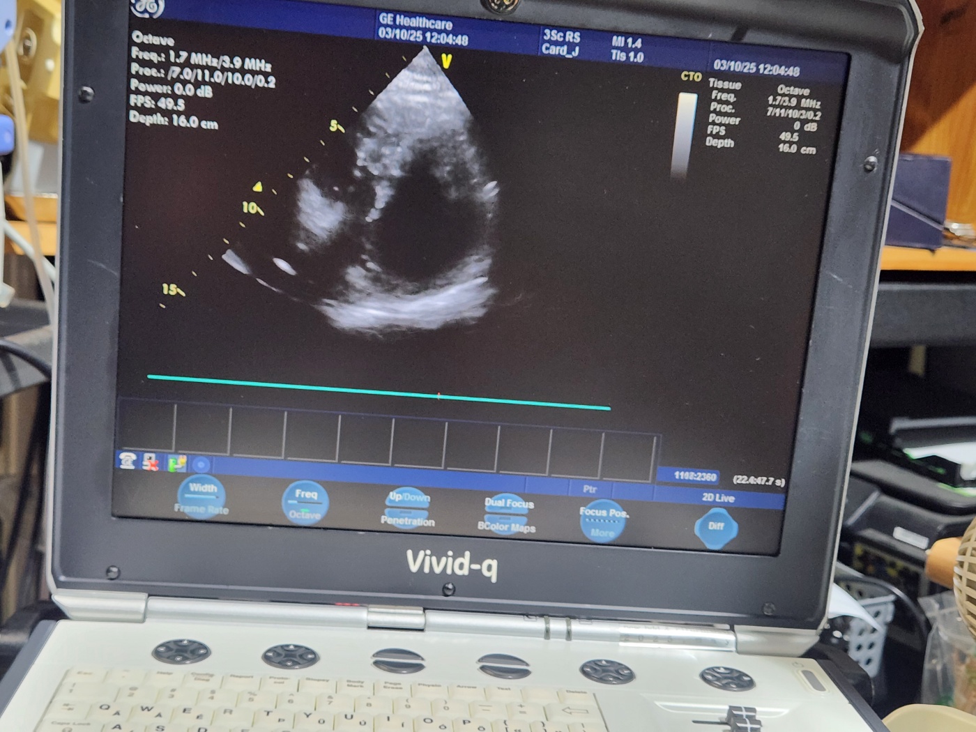 GE 3Sc-RS Sector Array Ultrasound Transducer Probe