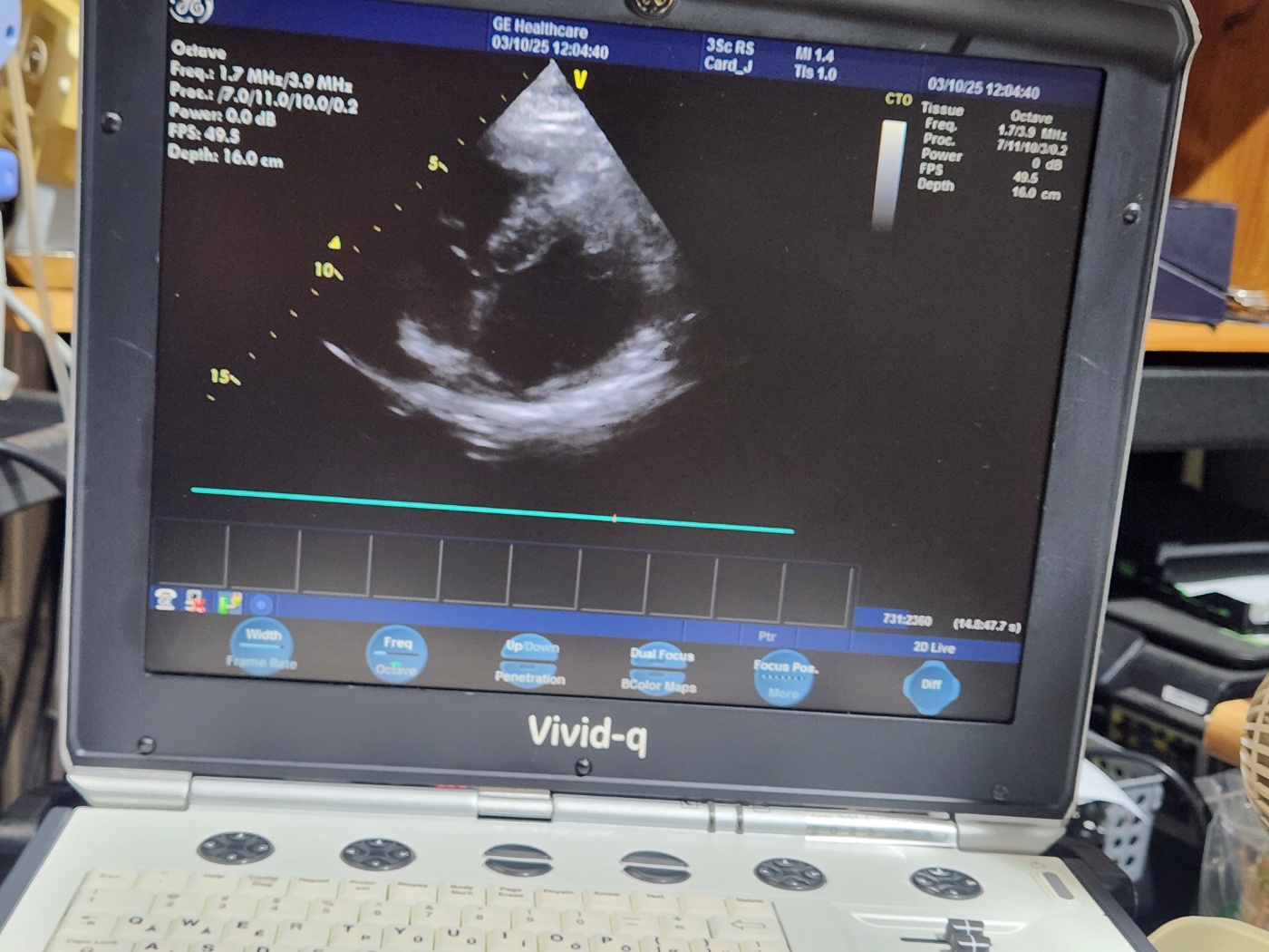 GE 3Sc-RS Sector Array Ultrasound Transducer Probe