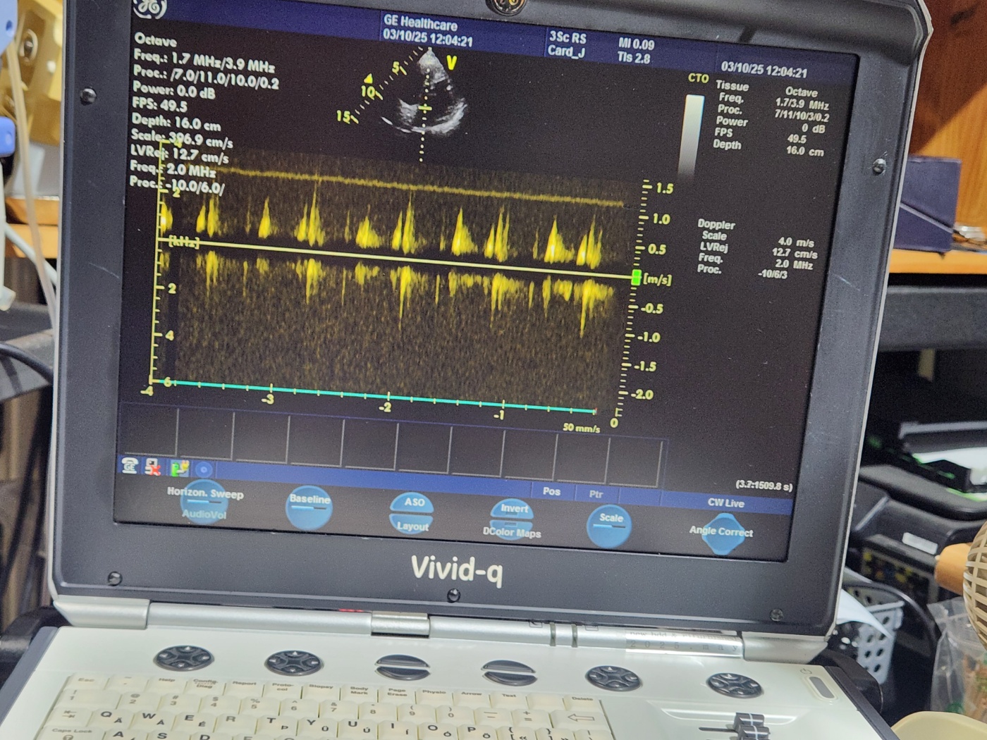GE 3Sc-RS Sector Array Ultrasound Transducer Probe