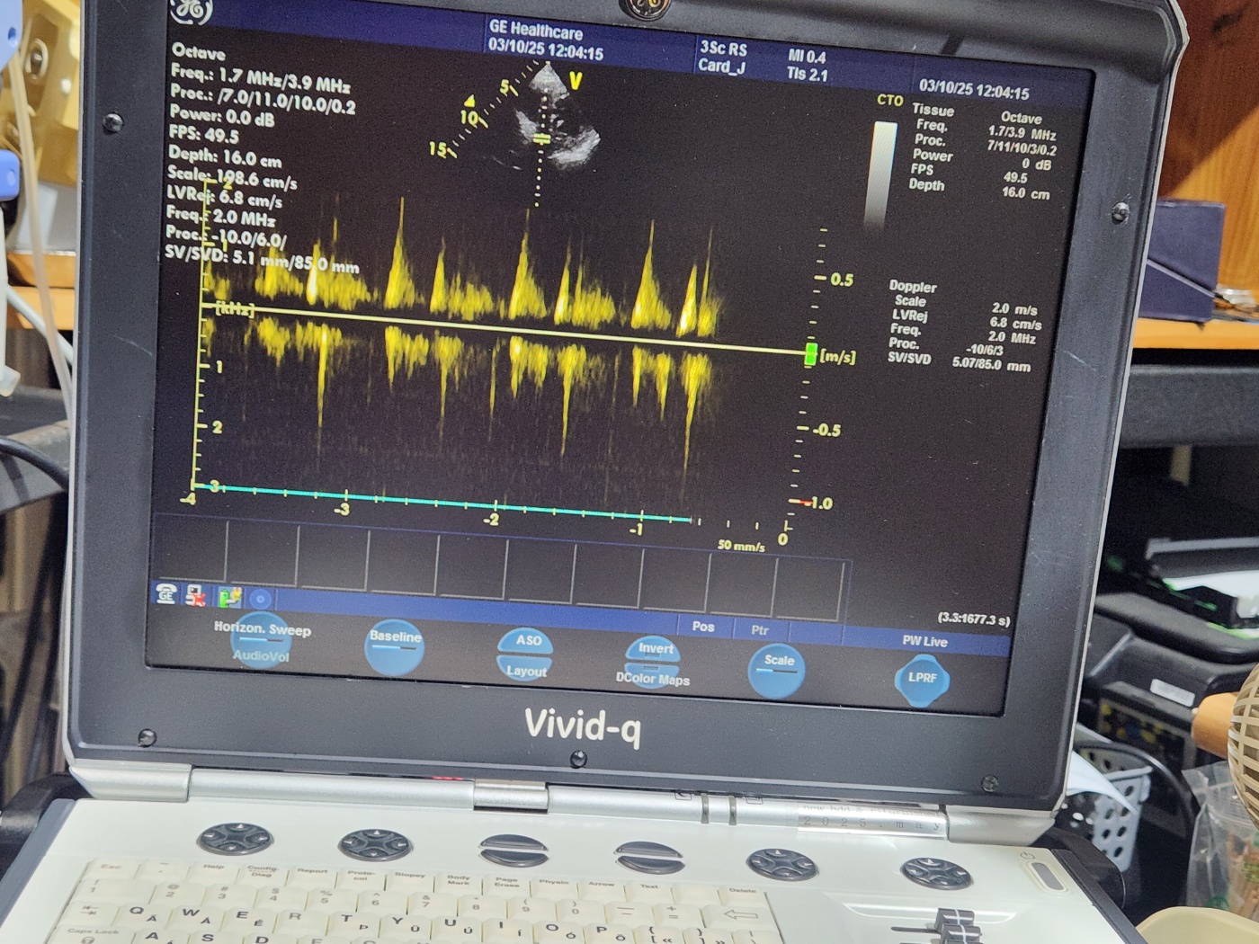 GE 3Sc-RS Sector Array Ultrasound Transducer Probe