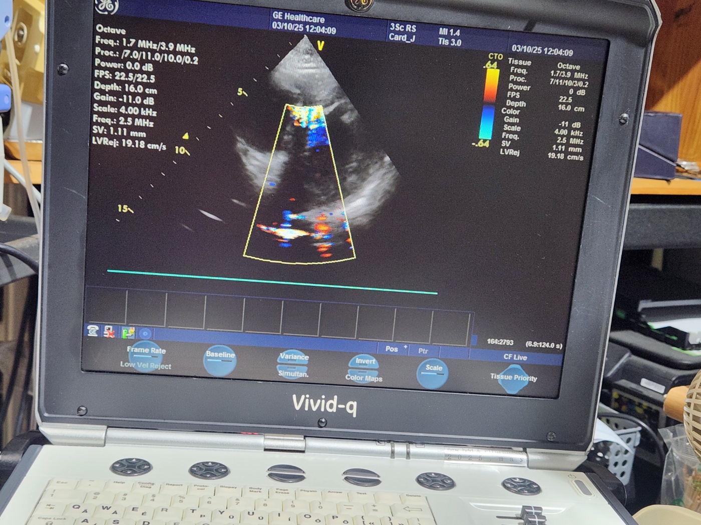 GE 3Sc-RS Sector Array Ultrasound Transducer Probe