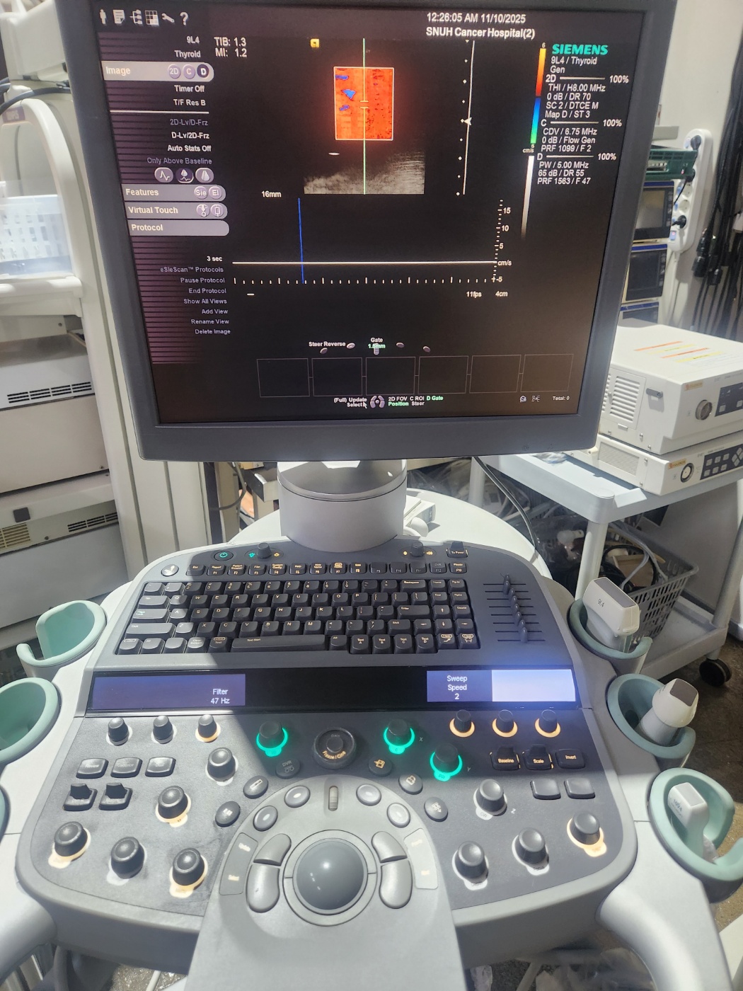 Siemens Acuson S2000   Ultrasound System