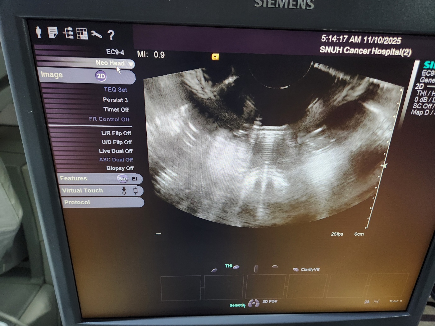 Siemens EC9-4 (S-Series) for Siemens Acuson S3000