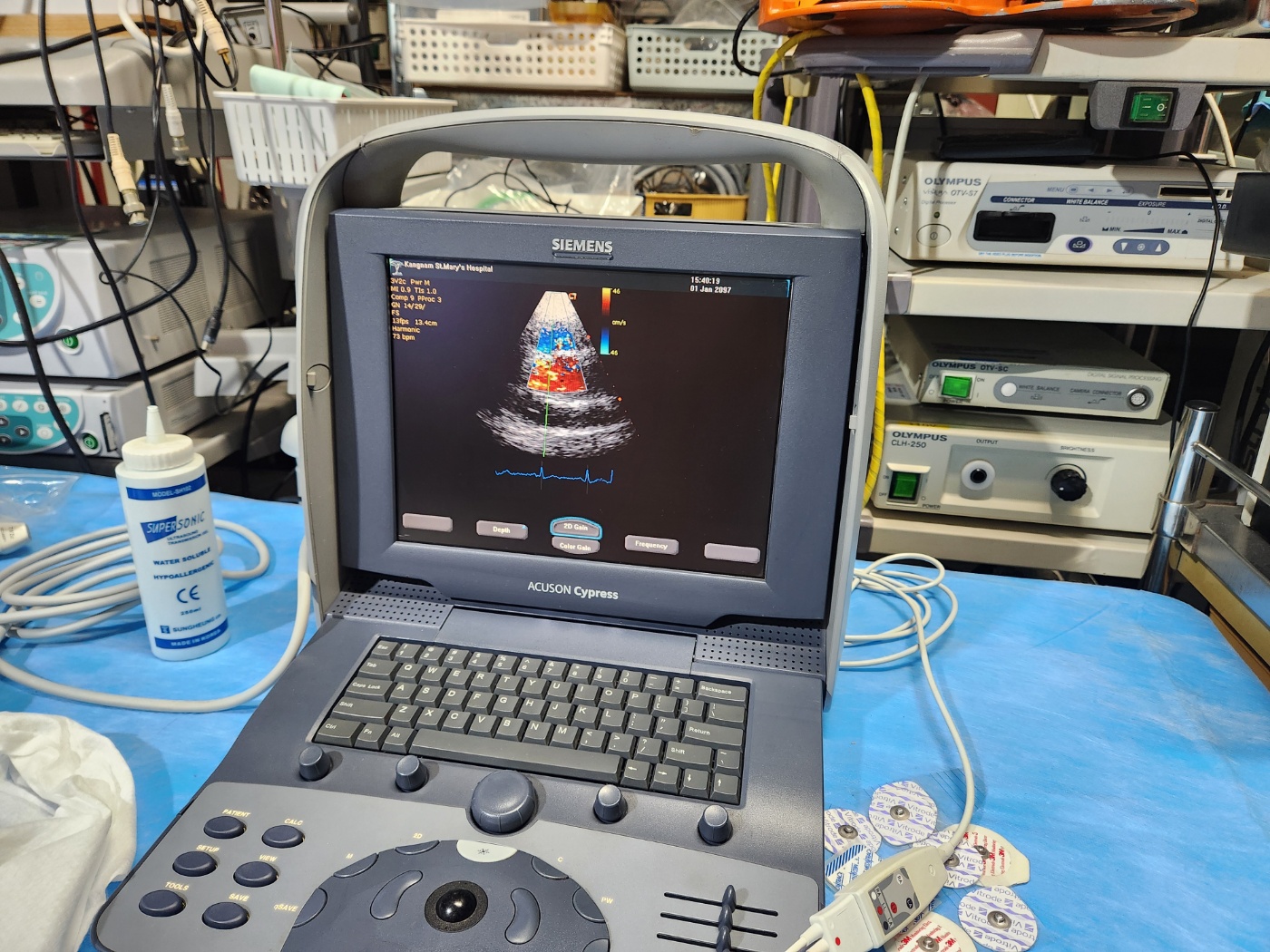 Siemens Acuson Cypress Ultrasound with 2 probes