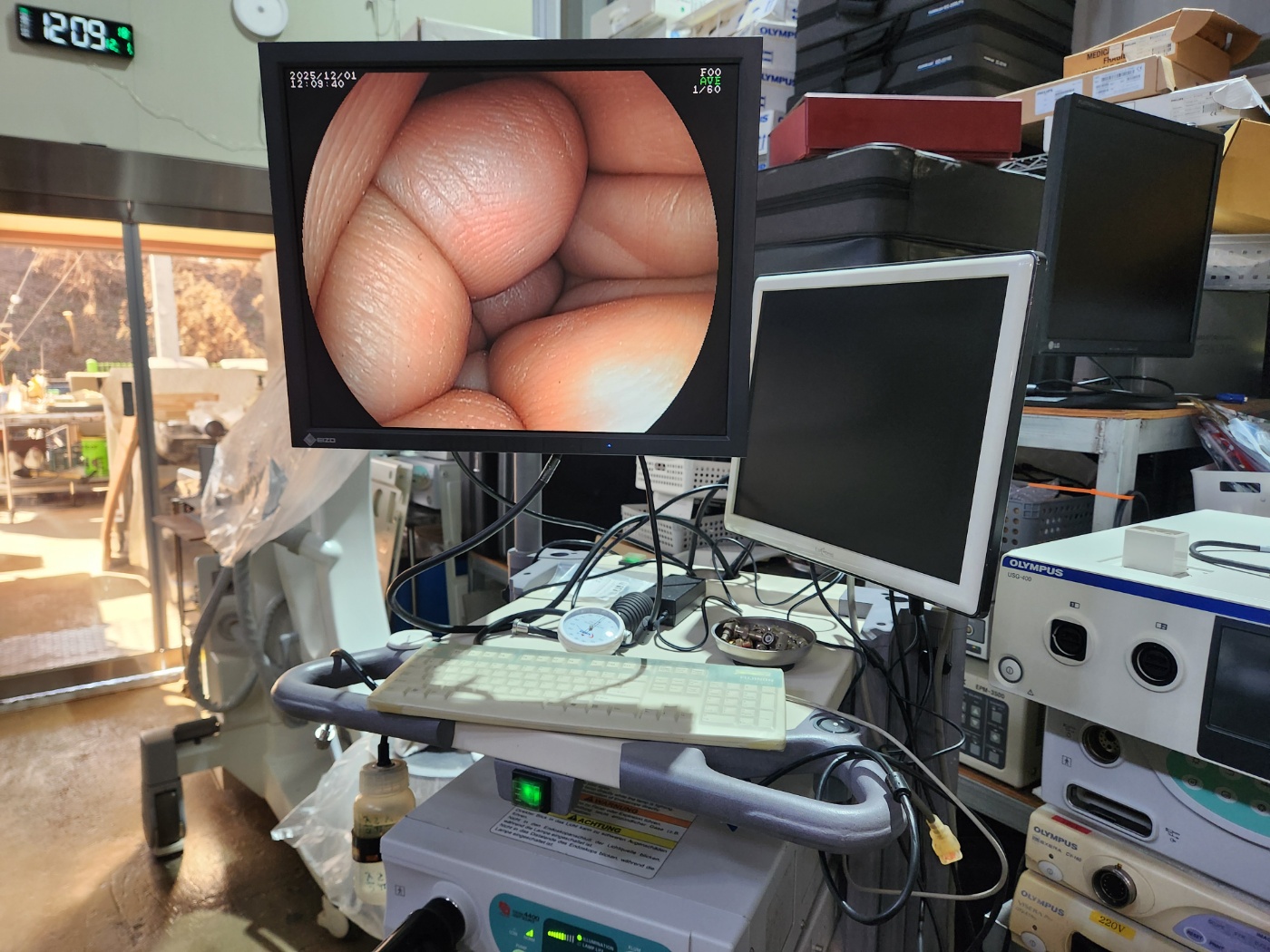 Fujinon EG-530WR Video Gastroscope