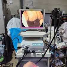 Fujinon EPX-2500 HD Complete Endoscopy System