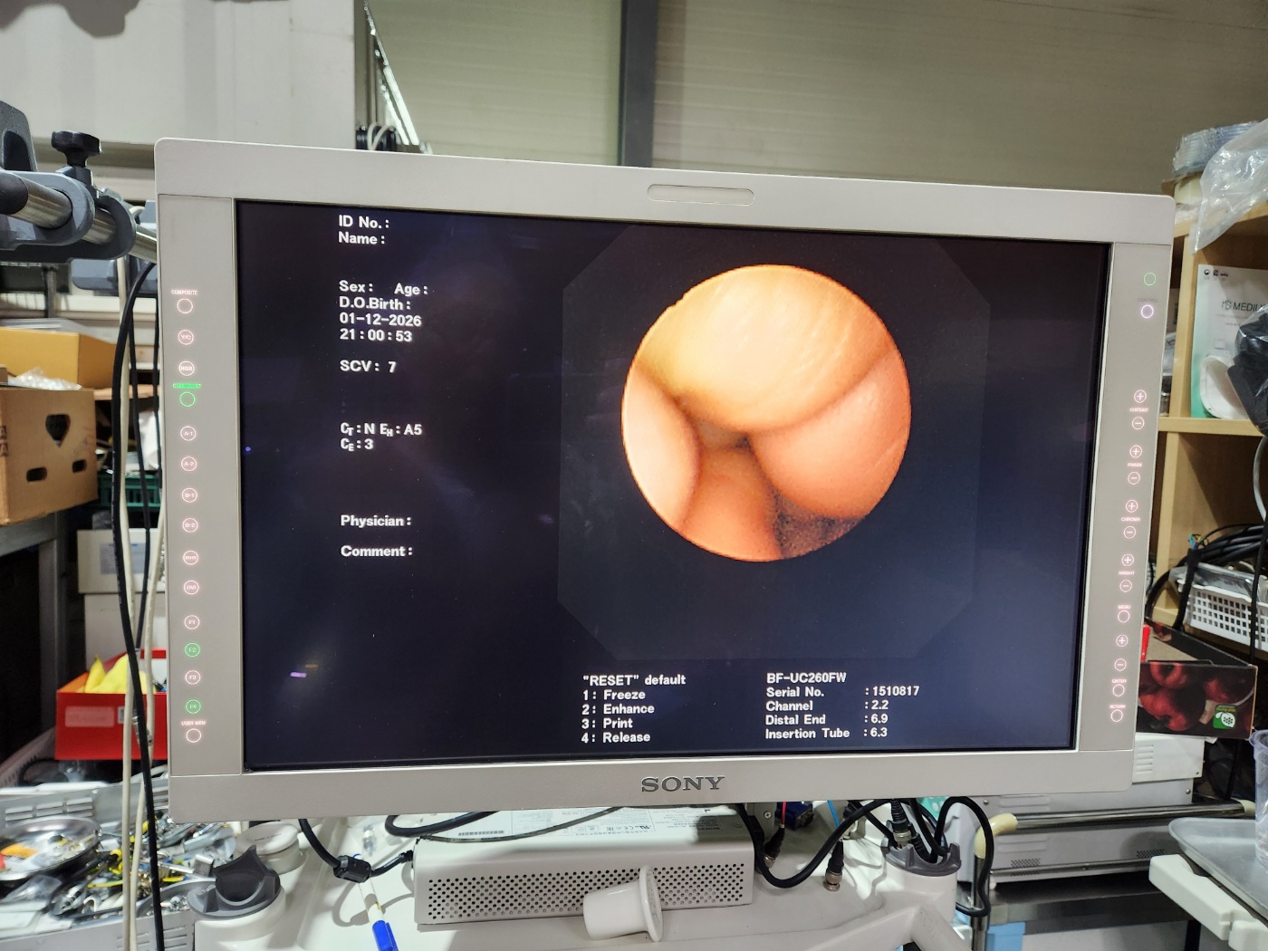 Olympus BF-UC260FW  Linear Ultrasound Bronchoscope