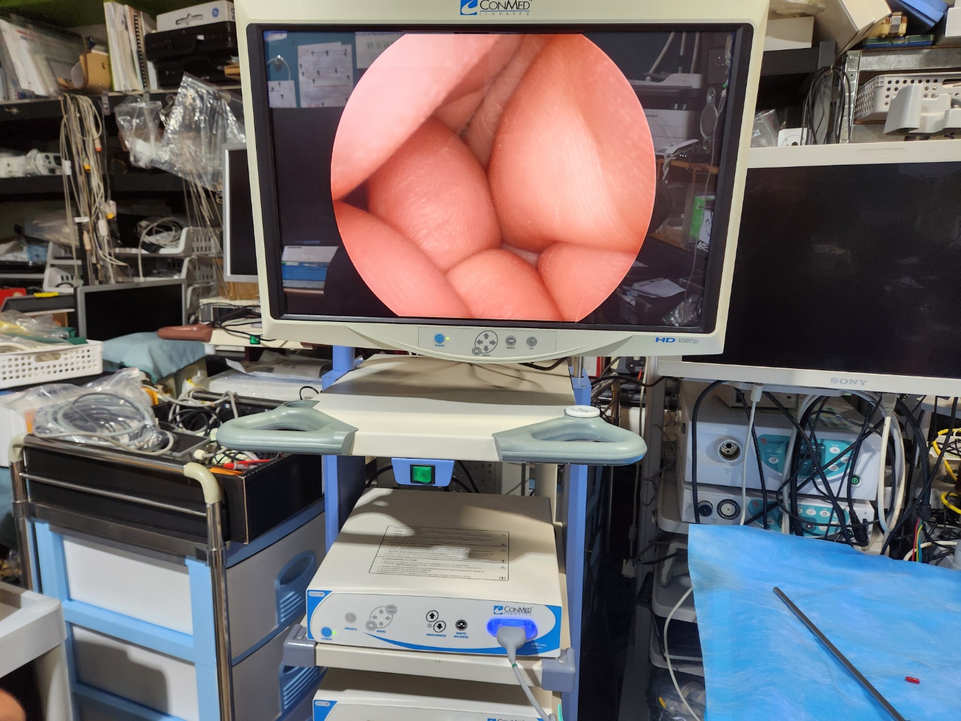 ConMed IM4000 HDTV Camera system