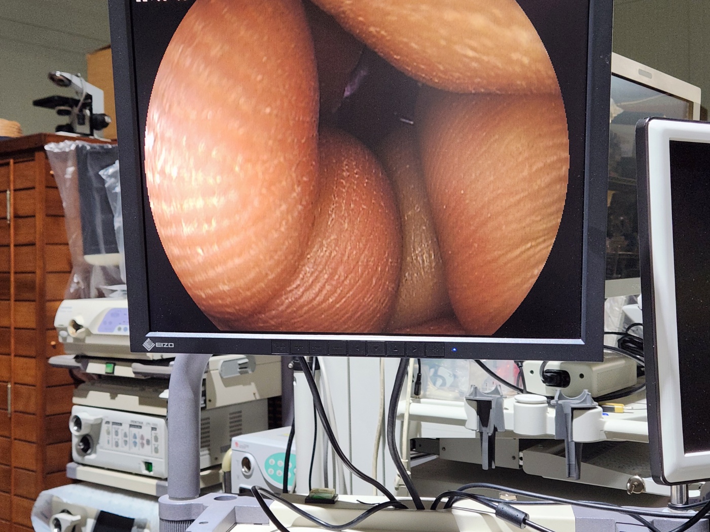 Fujinon EG-450WR5 Gastroscope