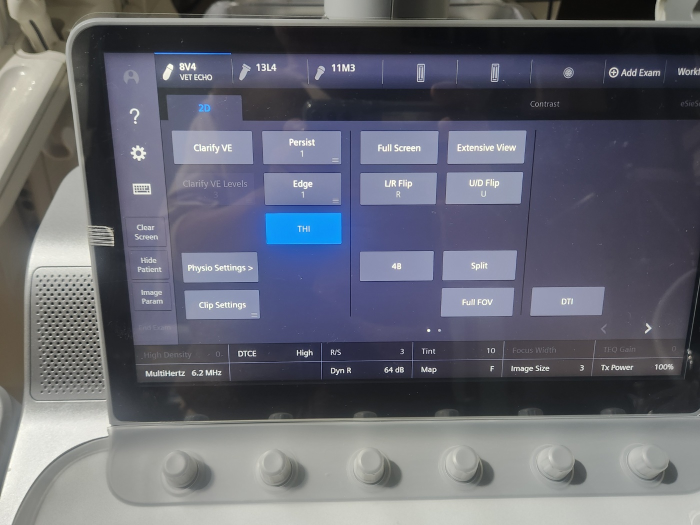 SIEMENS ACUSON Juniper