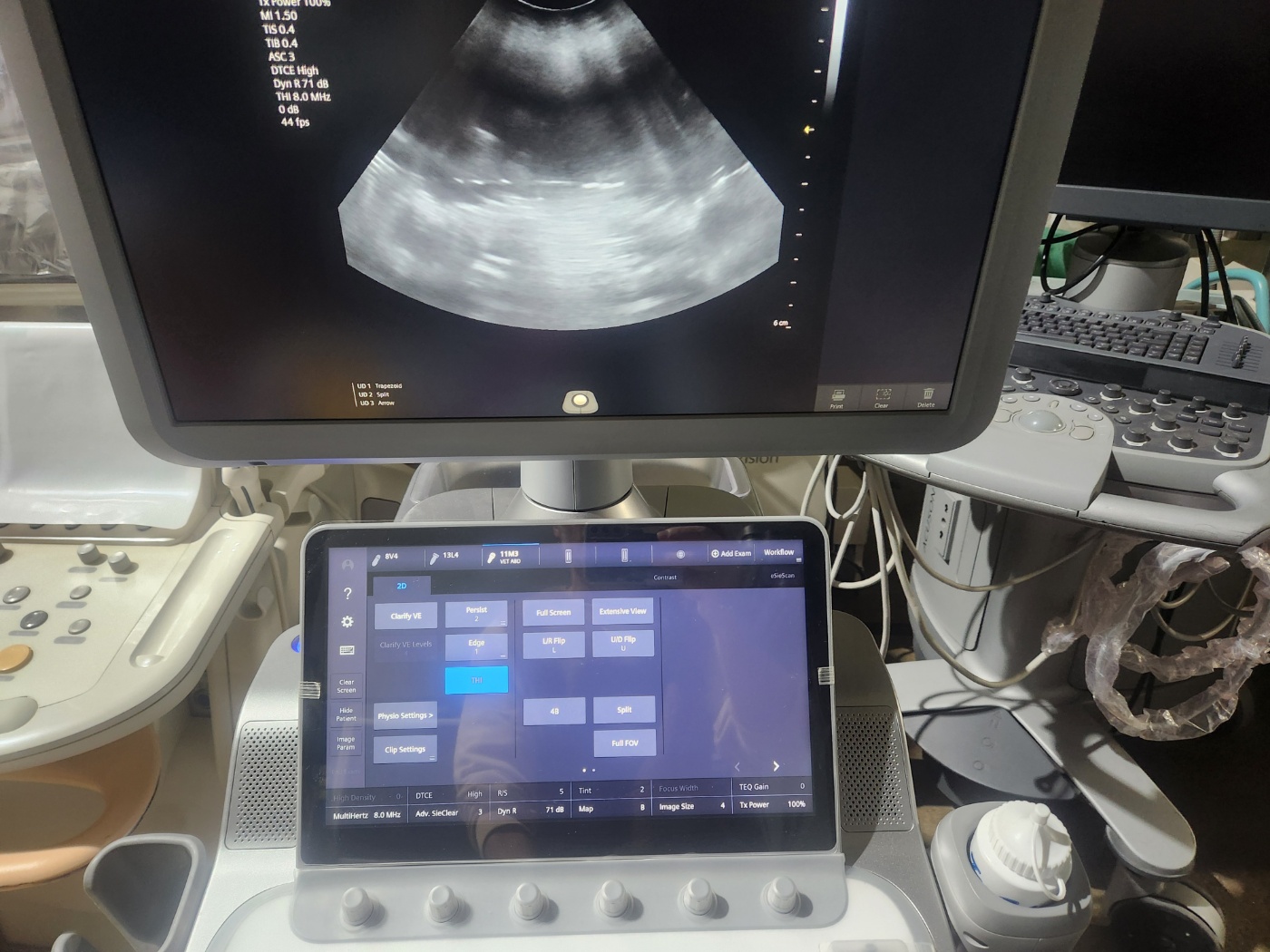 SIEMENS ACUSON Juniper