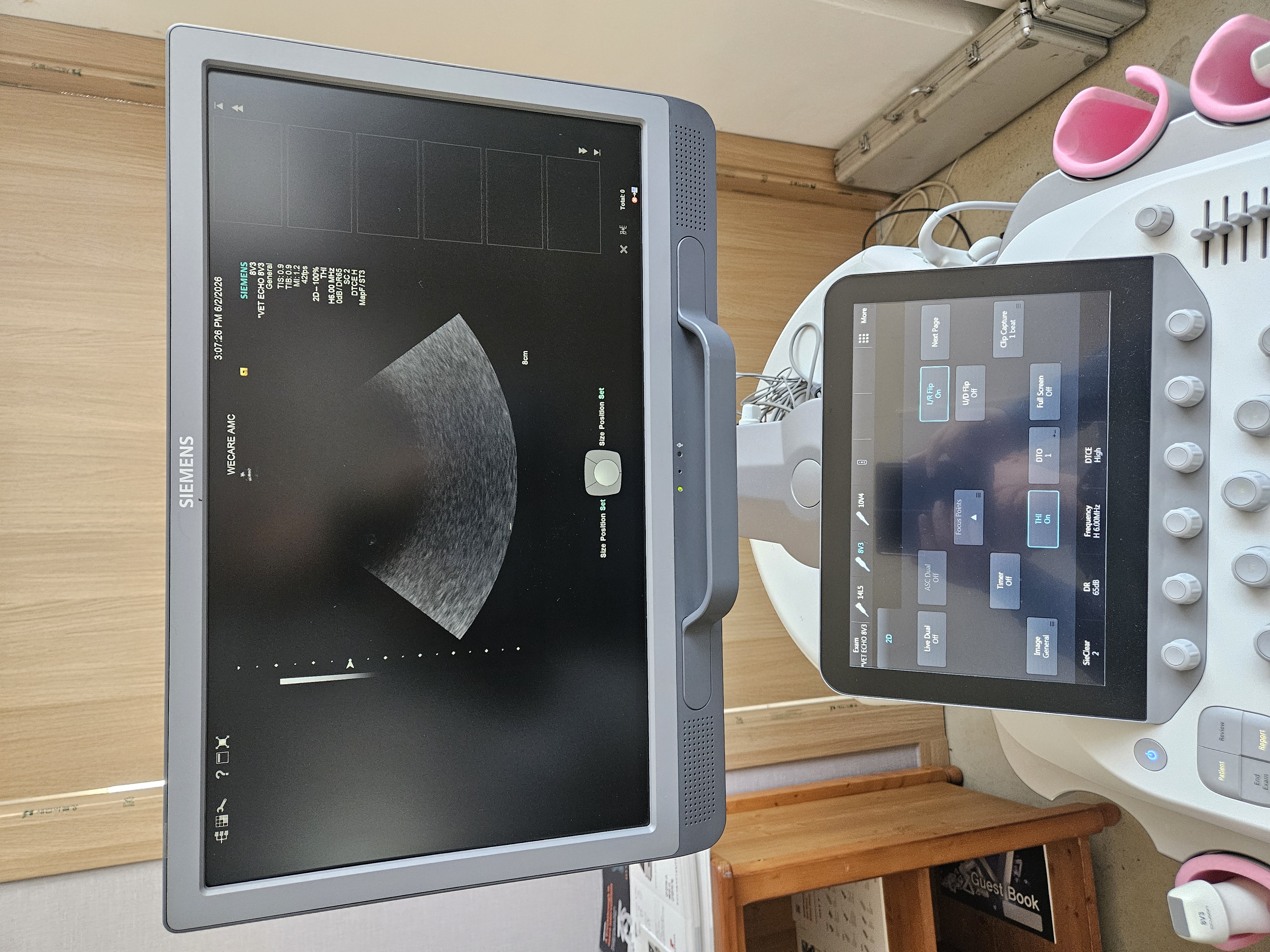 ACUSON S1000 Diagnostic Ultrasound System