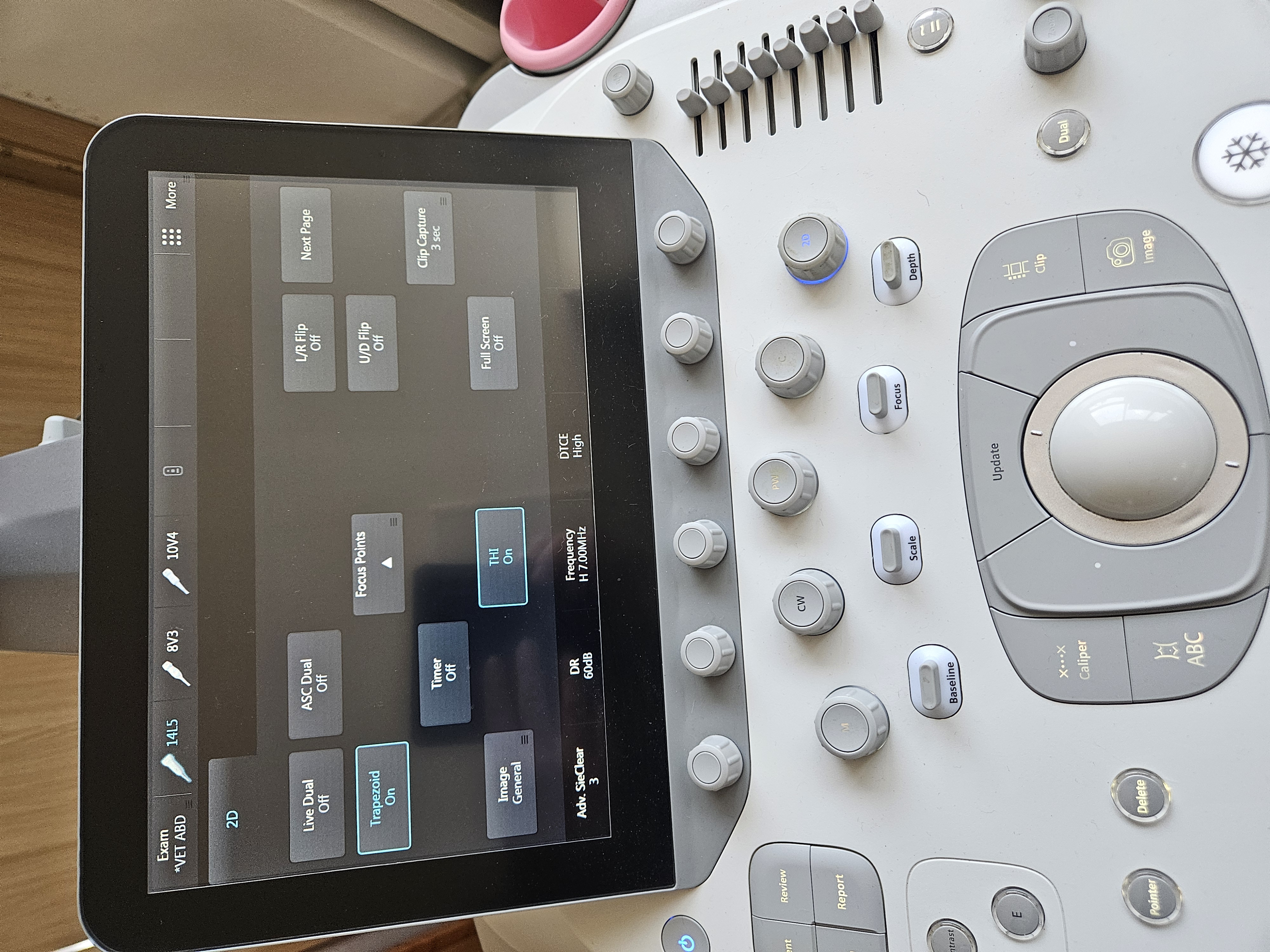 ACUSON S1000 Diagnostic Ultrasound System