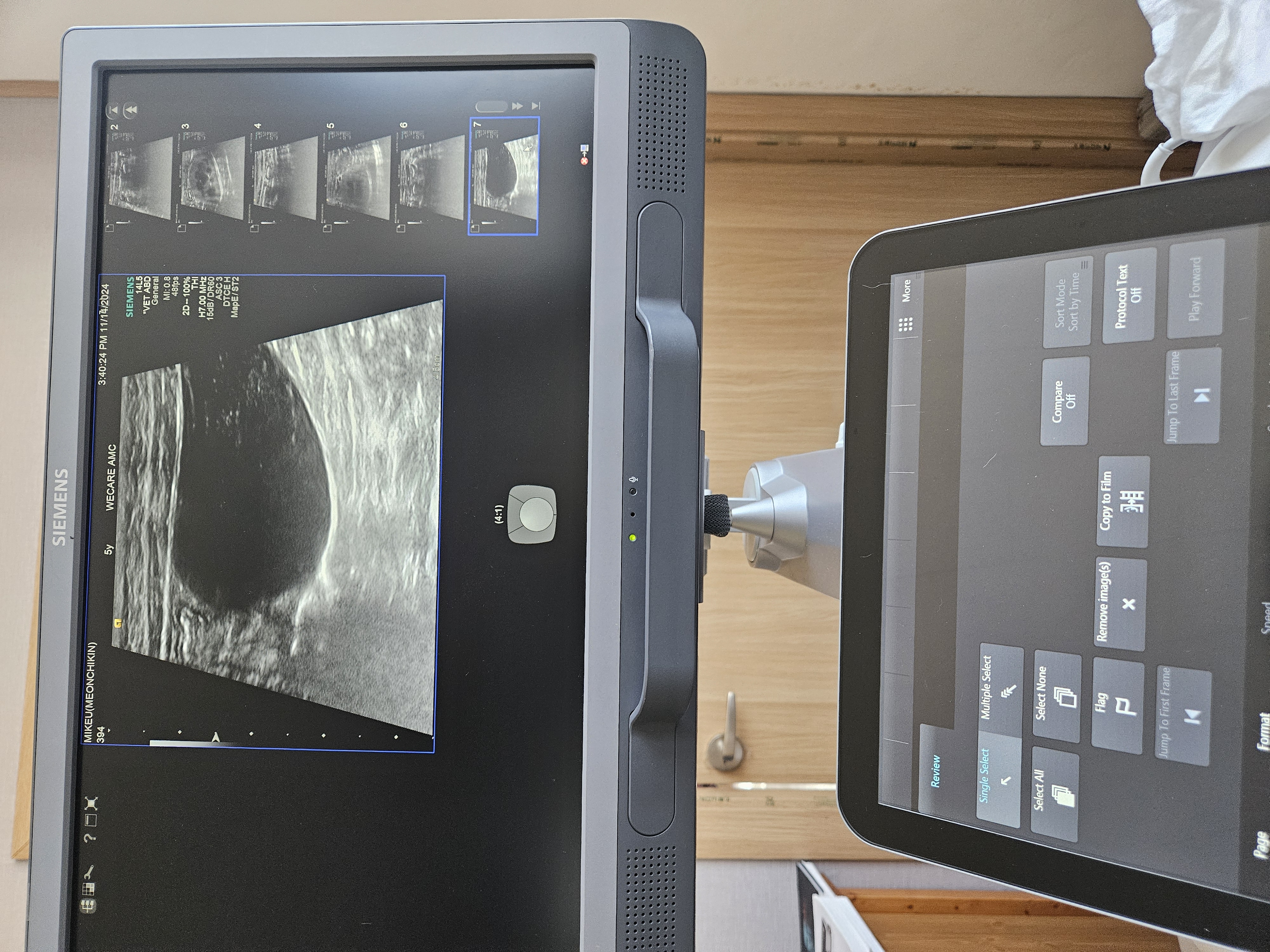 ACUSON S1000 Diagnostic Ultrasound System
