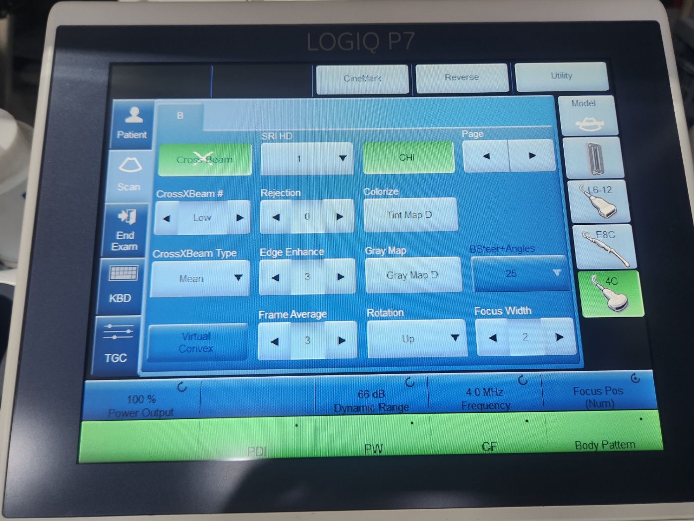GE LOGIQ P7 Ultrasound