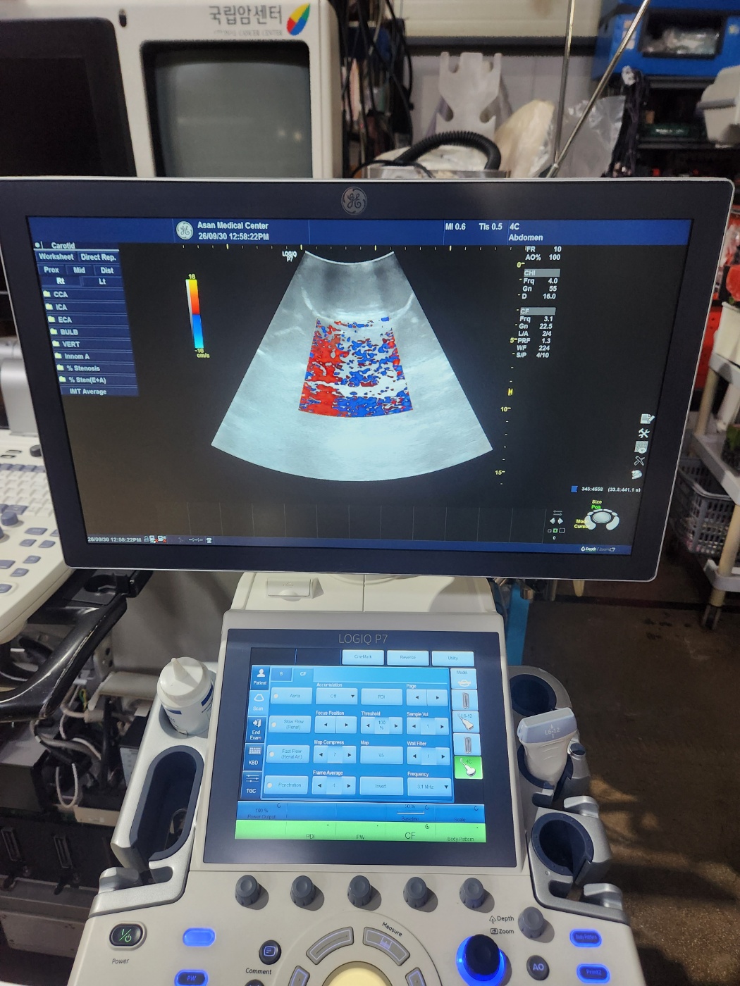 GE LOGIQ P7 Ultrasound