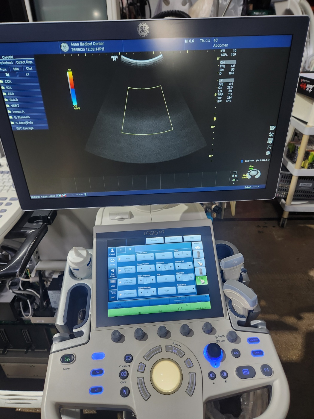 GE LOGIQ P7 Ultrasound