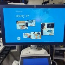 GE LOGIQ P7 Ultrasound