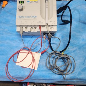 Conmed Hyfrecator 2000