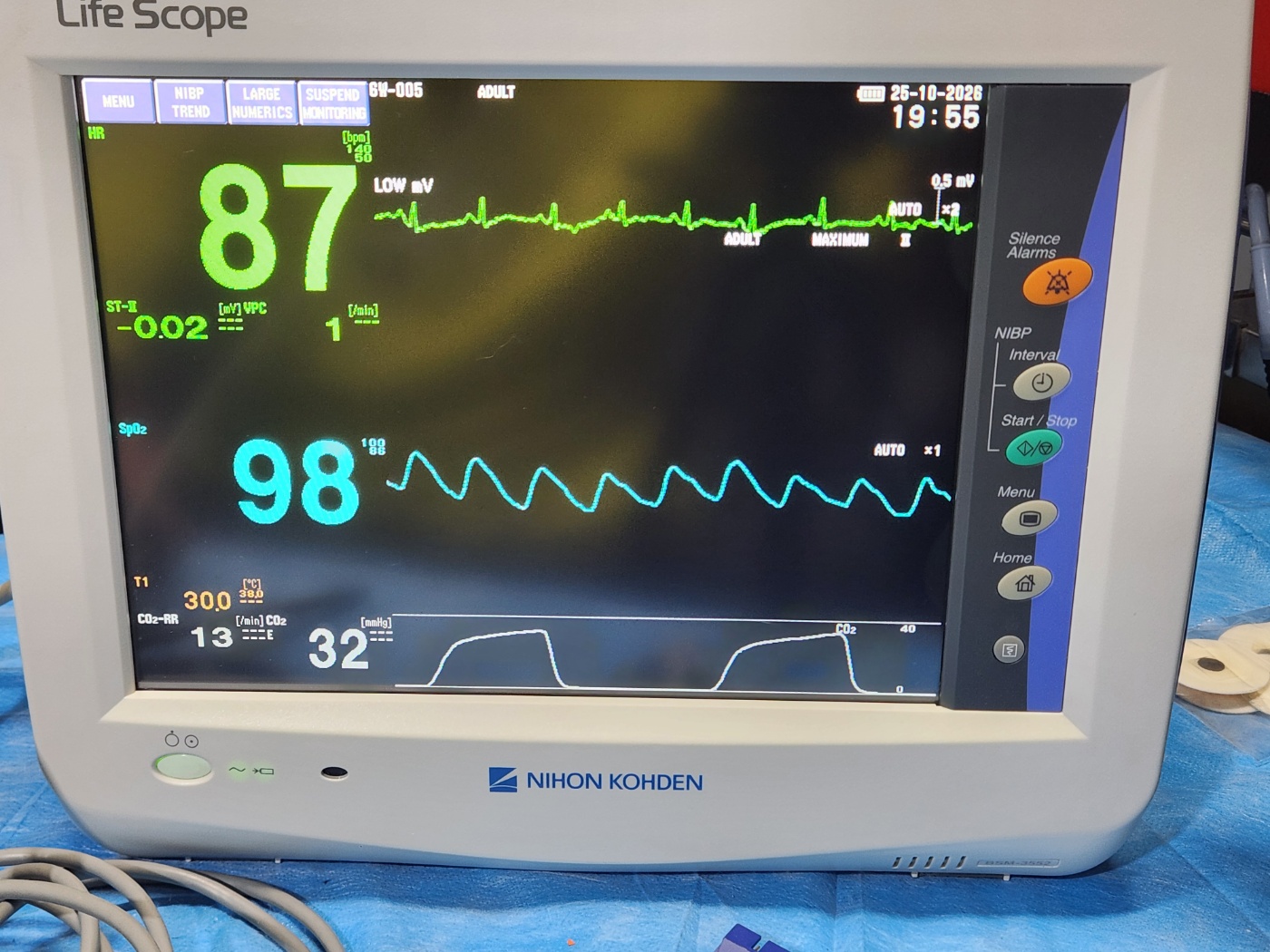 Nihon Kohden Life Scope BSM-3552 Patient Monitor